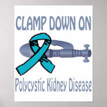 Clamp Down On Polycystic Kidney Disease Poster