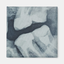 Close-up of a dental X-Ray Fridge Magnet