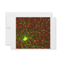 Close Up View of Retinal Ganglion Cell Invite