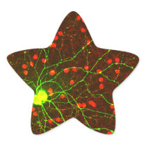 Close Up View of Retinal Ganglion Cell Star Stickers