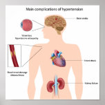 Complications of hypertension Any size Poster posters