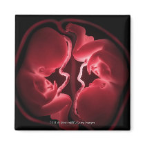 Conceptual image of a womb containing twins fridge magnet
