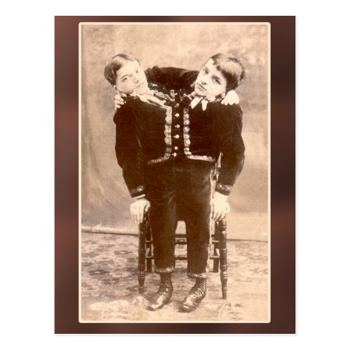 Conjoined Twins Vintage Cards and Postcards
