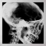 Creepy X-Ray Skull (Black & White) posters