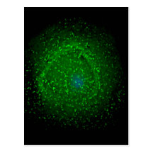 Description HIV-1 particles assembling at the surf Post Card