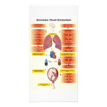 Diagram of an Amniotic Fluid Embolism AFE Photo Card