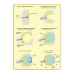 eye, evolution, diagram, evolution of the eye, eye