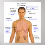 Diagram of the Main Symptoms of Diabetes in Humans posters