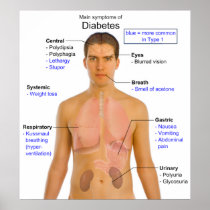 Diagram of the Main Symptoms of Diabetes in Humans Posters