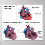 Diseases of the Heart Muscle Any size Poster posters