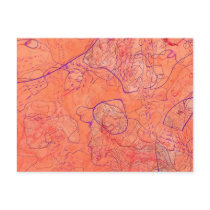 Dissection Post Card