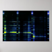 DNA Sequence gel 1 Posters