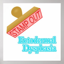Ectodermal Dysphasia Posters