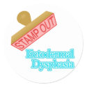 Ectodermal Dysphasia