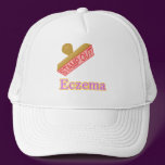 Eczema