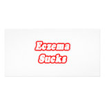 Eczema Sucks