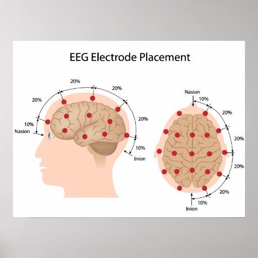 Eeg Electrode Placement Diagram Poster