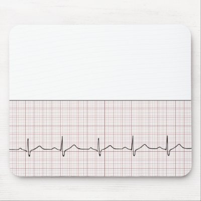 Mouse Ekg