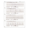 ekg Rhythms posters