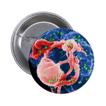 Electron Micrograph of HIV-1 Budding Lymphocyte Pinback Buttons