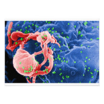 Electron Micrograph of HIV-1 Budding Lymphocyte Invitations