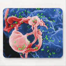 Electron Micrograph of HIV-1 Budding Lymphocyte Mouse Pads