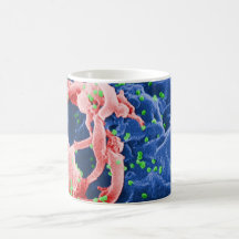 Electron Micrograph of HIV-1 Budding Lymphocyte Coffee Mug