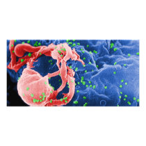 Electron Micrograph of HIV-1 Budding Lymphocyte Customized Photo Card