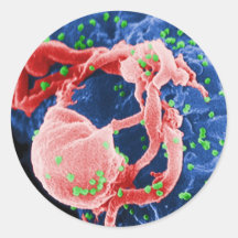 Electron Micrograph of HIV-1 Budding Lymphocyte Stickers