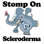 Elephant Stomp On Scleroderma Photo Sculpture