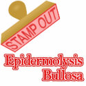 Epidermolysis Bullosa
