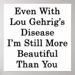 Even With Lou Gehrig's Disease I'm Still More Beau posters