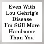 Even With Lou Gehrig's Disease I'm Still More Hand posters