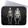 Evolution Man and Ape Skeletons Laptop Computer Sleeve