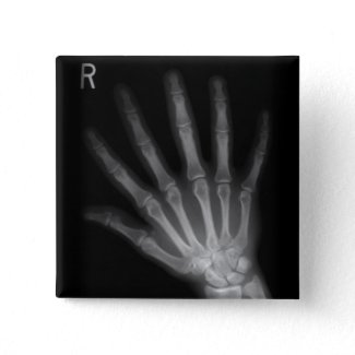 Extra Digit X-ray Right Hand button