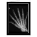 Extra Digit X-ray Right Hand Card
