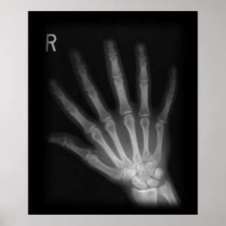 Current image with printable x rays Adorable image for printable x rays