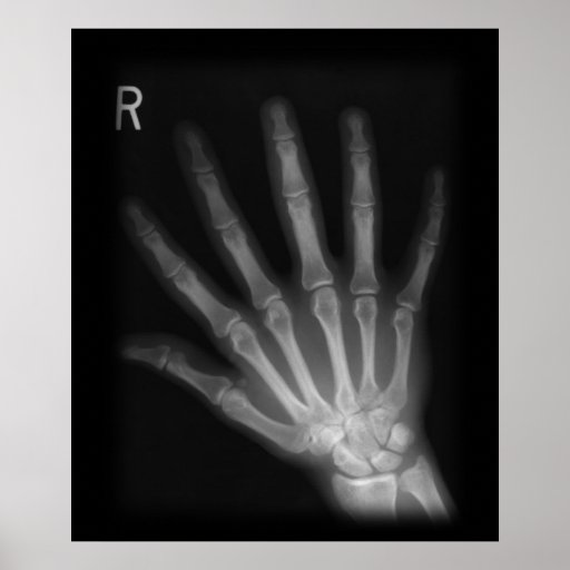 Extra Digit Xray Right Hand Print Zazzle
