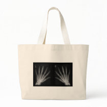 Extra Digit X-ray Right & Left Hands Bags