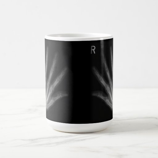 Extra Digit X-ray Right & Left Hands Coffee Mug
