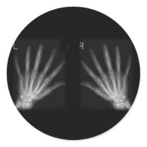 Extra Digit X-ray Right & Left Hands Round Sticker
