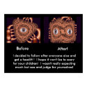 Face Lift Promo Poster posters by Rb_barnes2 Face Lift Promo Poster posters