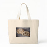 fetal case bags