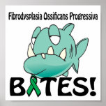 Fibrodysplasia Ossificans Progressiva BITES Posters