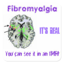 Fibromyalgia is real. fMRI proof Stickers