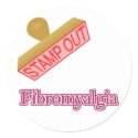 Fibromyalgia