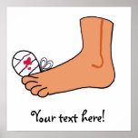 Foot-2 Broken Toe Posters