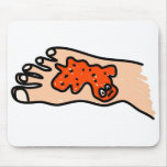 Foot Disease Mouse Mats