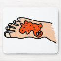 Foot Disease mousepads