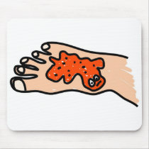Foot Disease mousepads by prawny Foot Disease mousepads